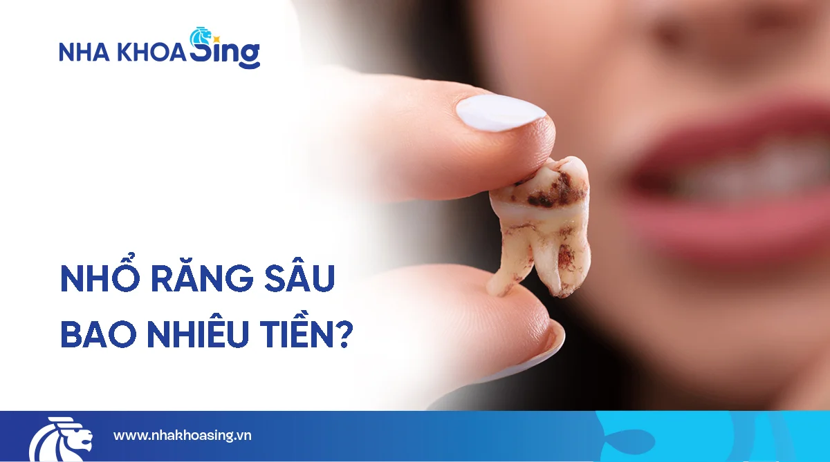 Nhổ răng sâu bao nhiêu tiền? Quy trình và các yếu tố ảnh hưởng