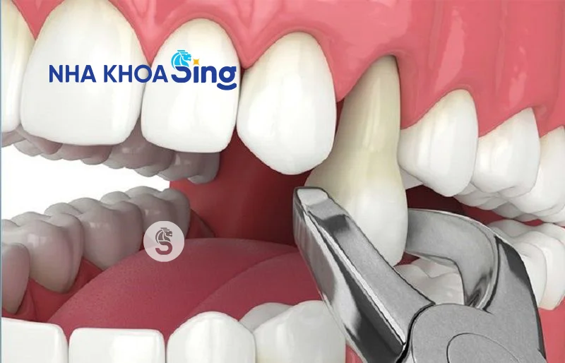 nho-rang-so-4-1