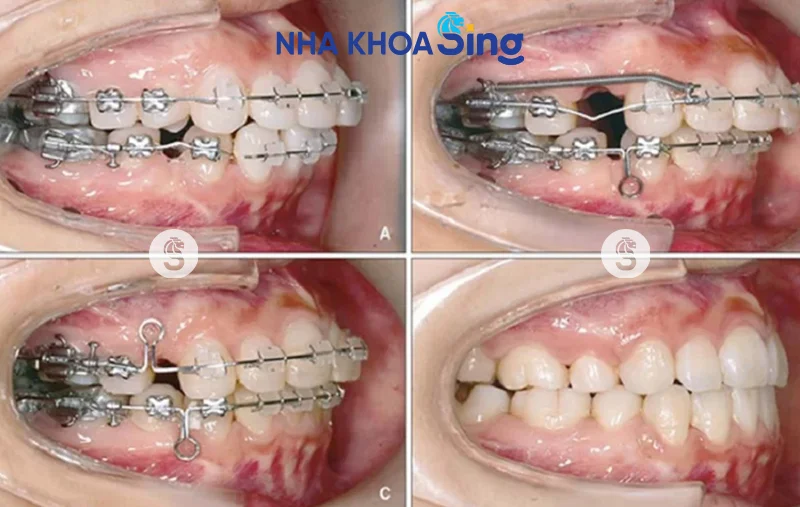 nho-rang-so-4-2