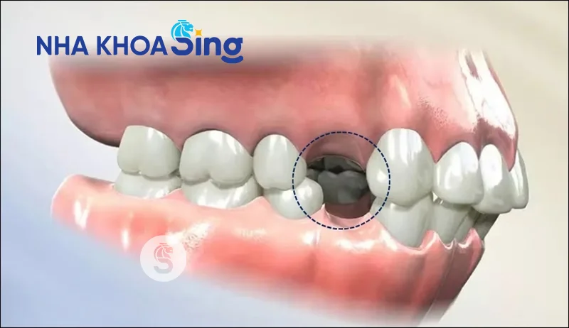 nho-rang-so-4