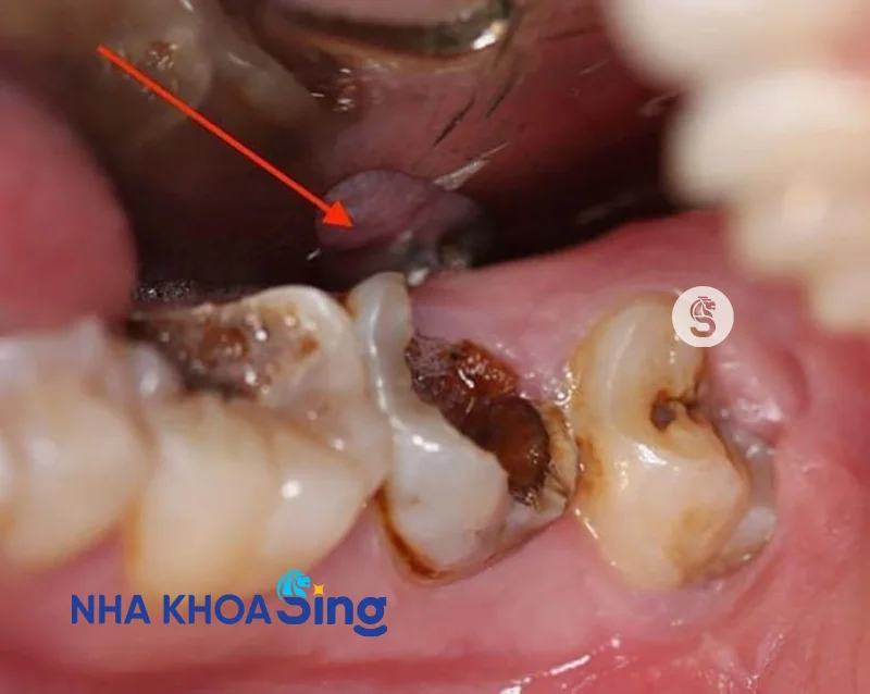 nho-rang-so-7-1