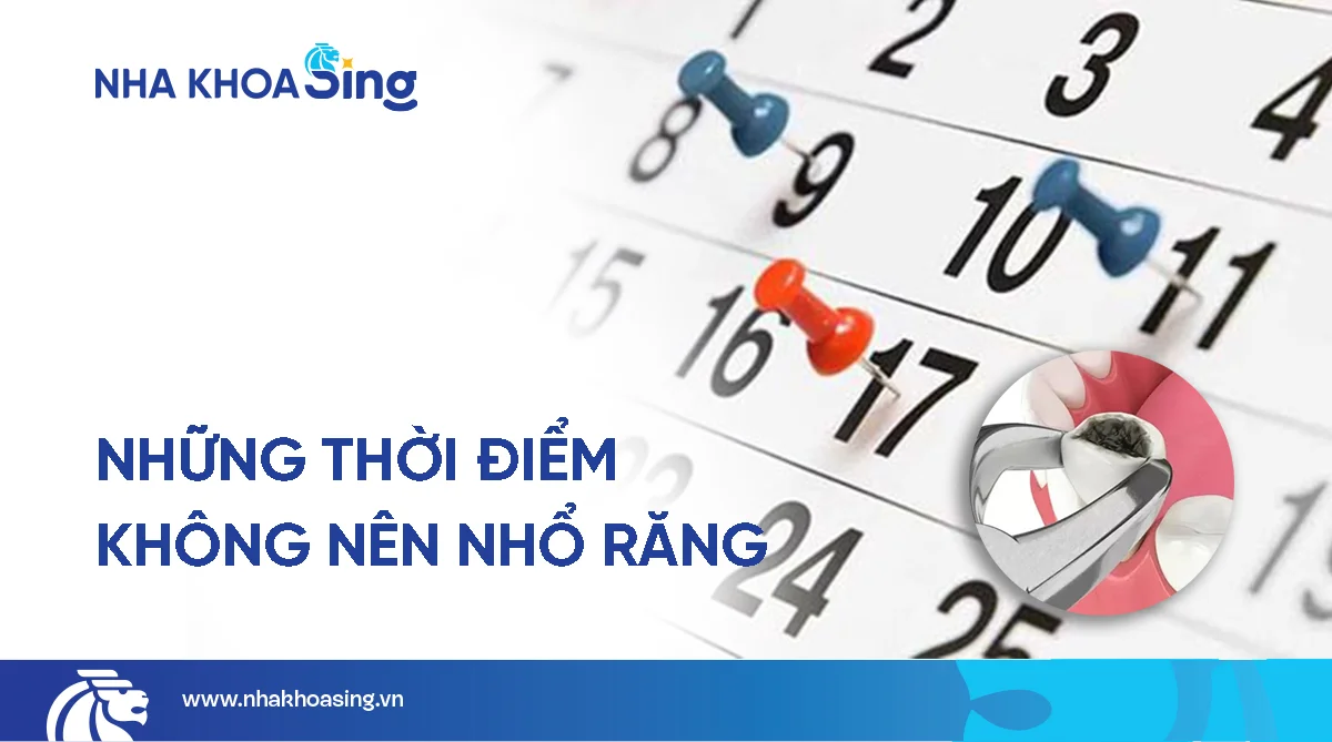 Những ngày không nên nhổ răng mà bạn cần biết