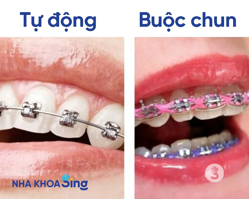 nieng-rang-la-gi-3