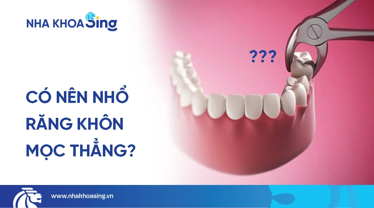 Răng khôn mọc thẳng có cần nhổ không? Chuyên gia tư vấn
