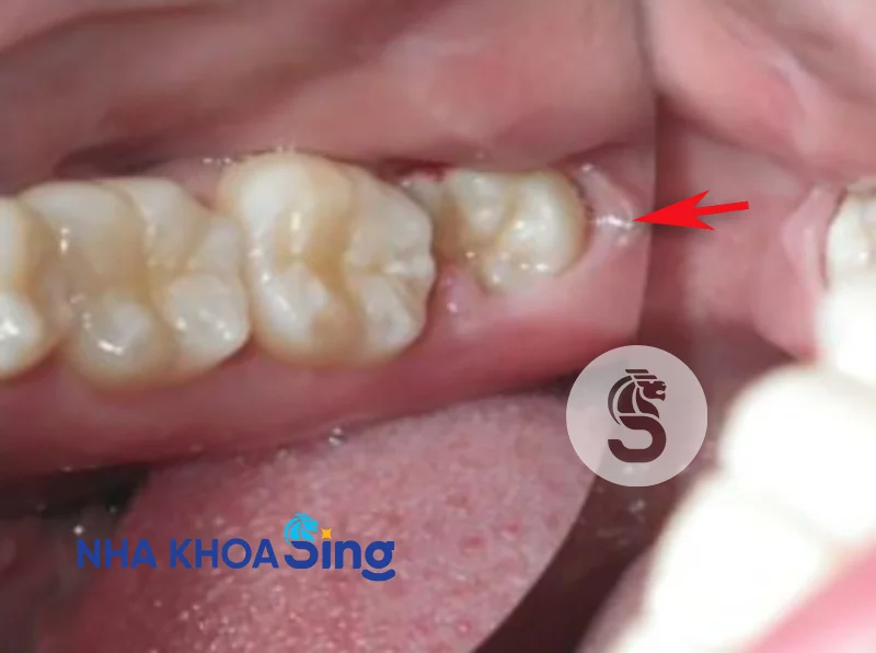 rang-khon-moi-nhu-co-nho-duoc-khong-1