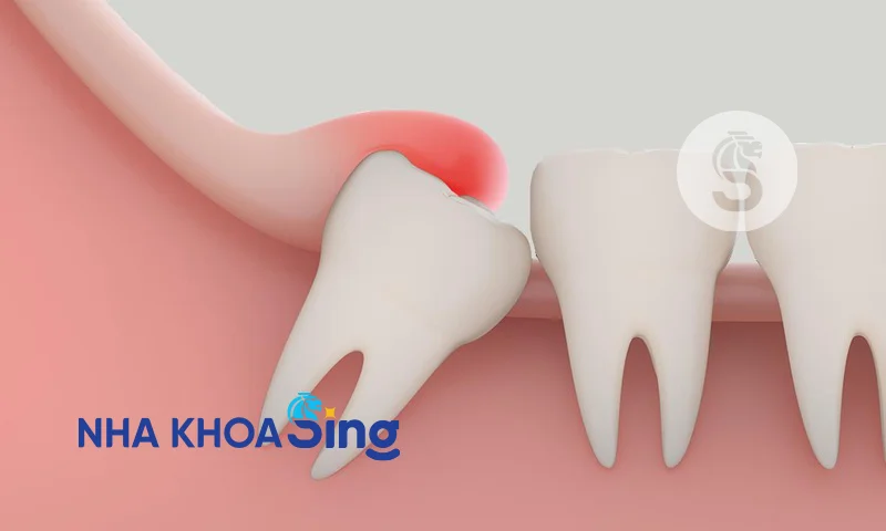 rang-khon-moi-nhu-co-nho-duoc-khong-2