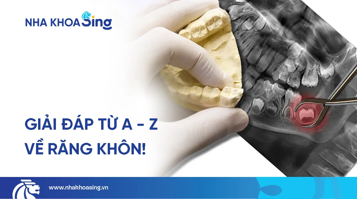 Răng khôn là gì? Những điều bạn cần biết trước khi nhổ