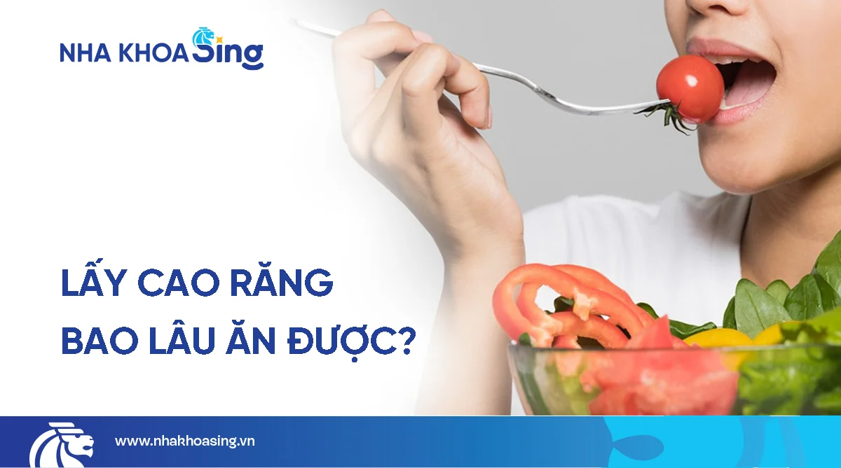 Sau khi lấy cao răng bao lâu thì được ăn? Gợi ý thực đơn phù hợp
