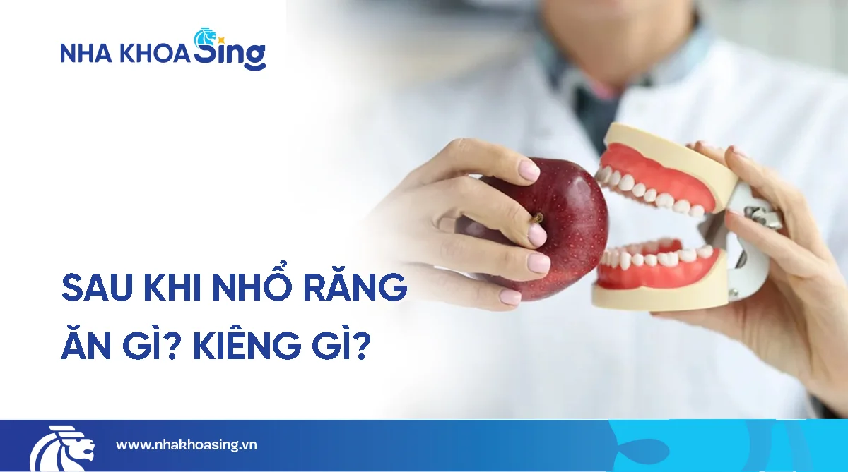 Mới nhổ răng nên ăn gì? kiêng gì? Hướng dẫn ăn uống sau khi nhổ răng