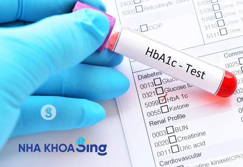 tieu-duong-co-trong-rang-implant-duoc-khong-2