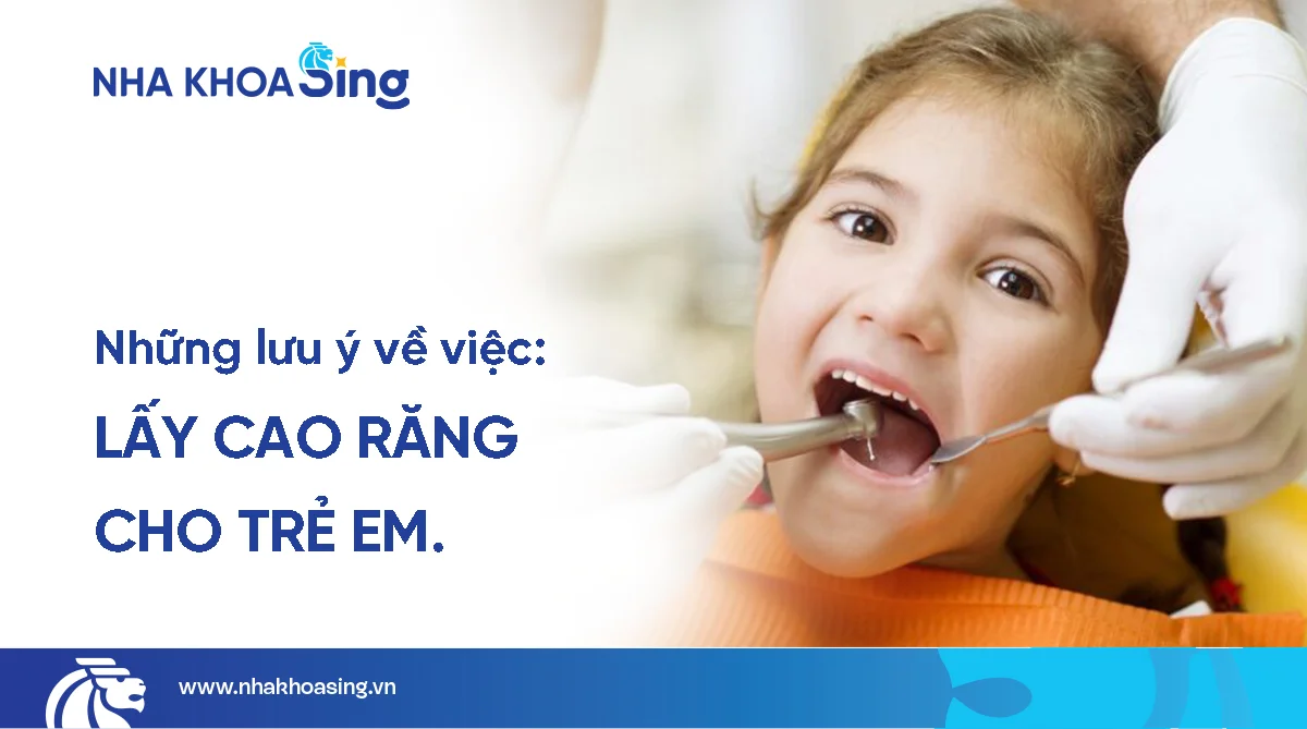 Trẻ em có nên lấy cao răng không? Khi nào? Ở đâu?