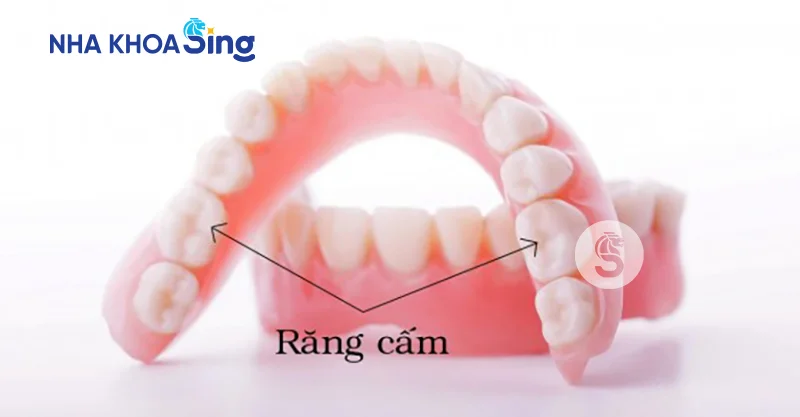 trong-rang-cam-gia-bao-nhieu-1