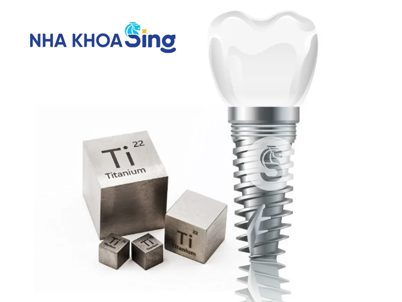 trong-rang-implant-co-chup-mri-duoc-khong-2