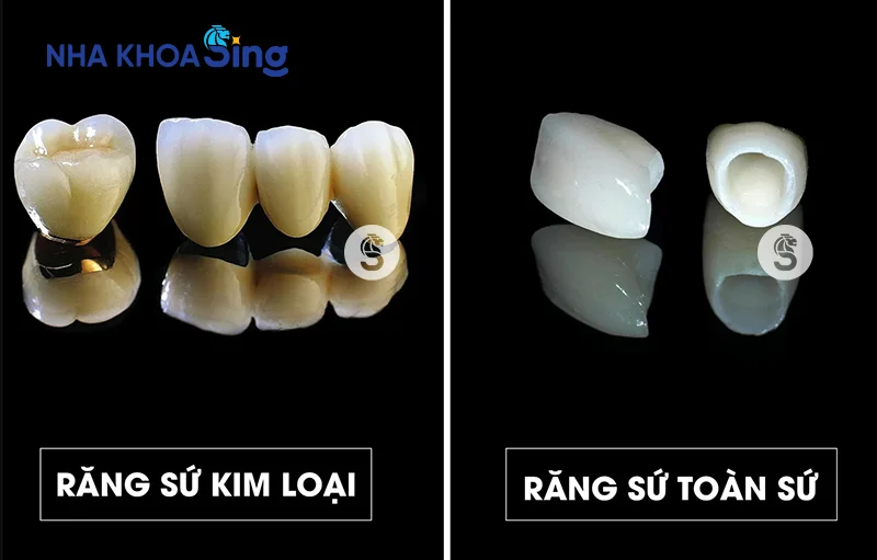 trong-rang-implant-co-chup-mri-duoc-khong-3