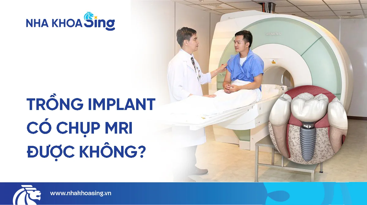 Trồng răng Implant có chụp MRI được không? Giải đáp từ chuyên gia