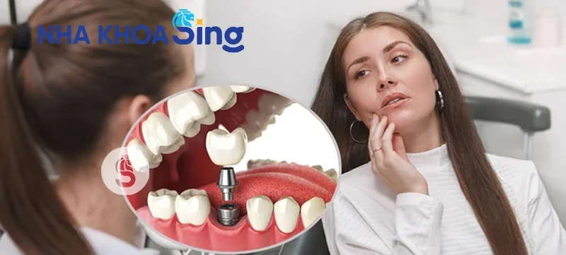 trong-rang-implant-co-dau-khong-2