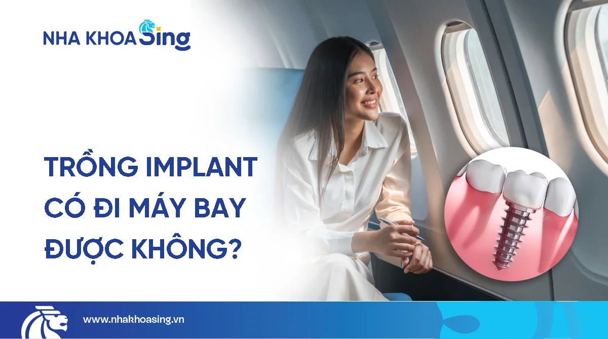 Trồng răng Implant có đi máy bay được không? Giải đáp từ chuyên gia
