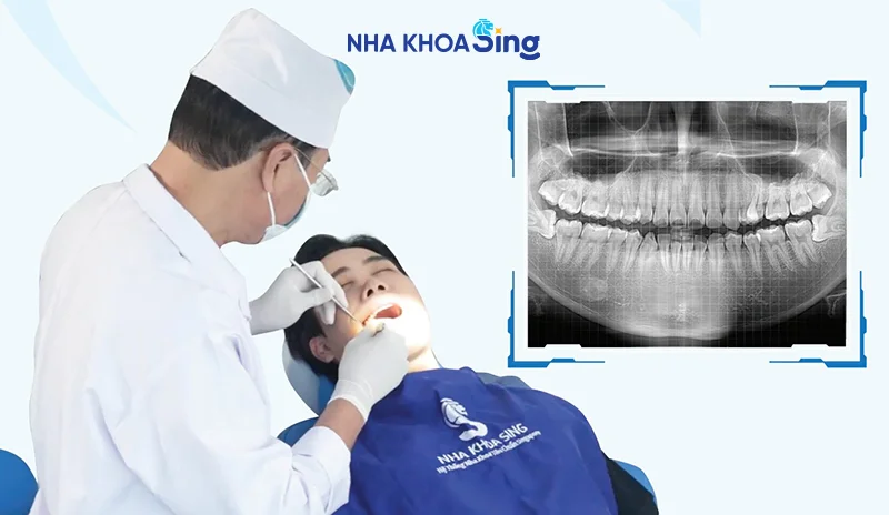 trong-rang-implant-co-duoc-bao-hiem-khong-2