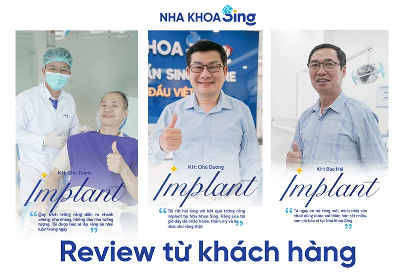 trong-rang-implant-co-duoc-bao-hiem-khong-3