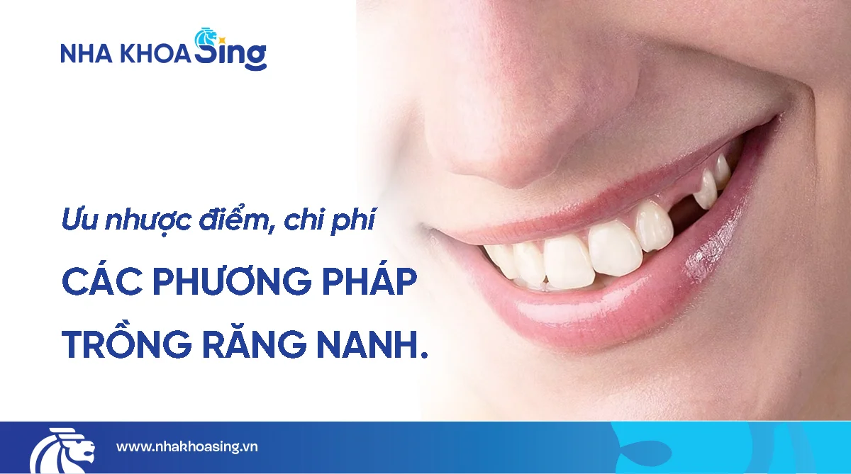 Trồng răng nanh: Phương pháp, chi phí & giải pháp an toàn