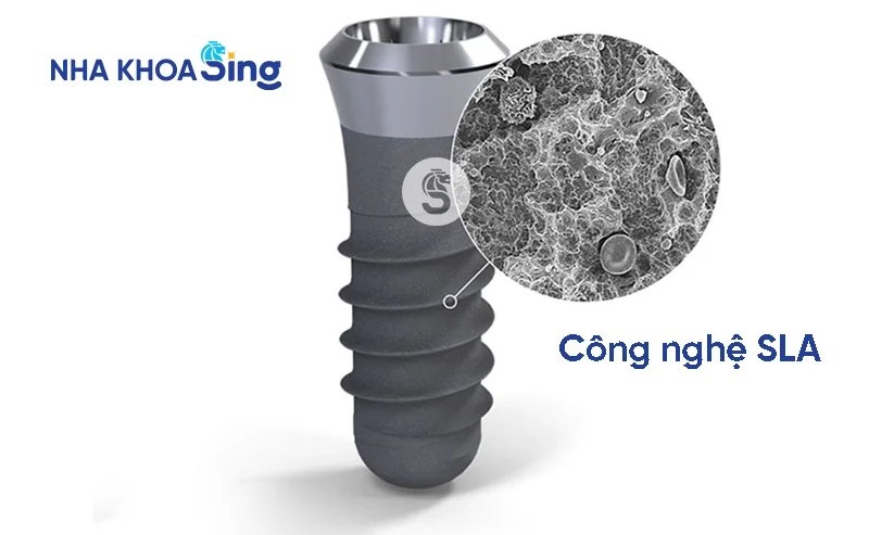 tru-implant-han-quoc-2