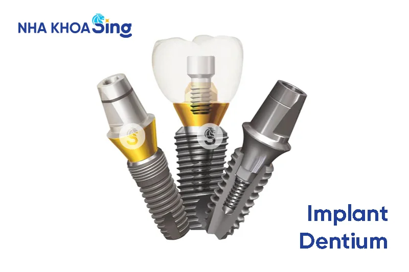 tru-implant-han-quoc