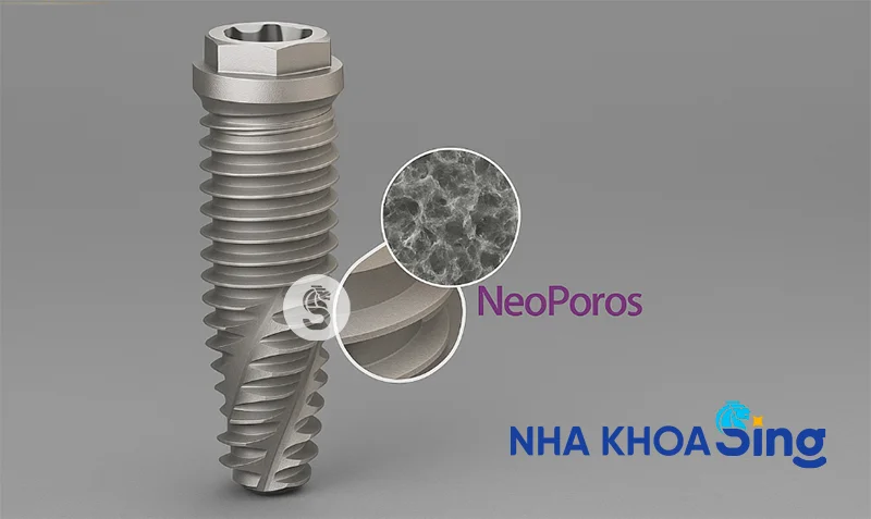 tru-implant-neodent-1