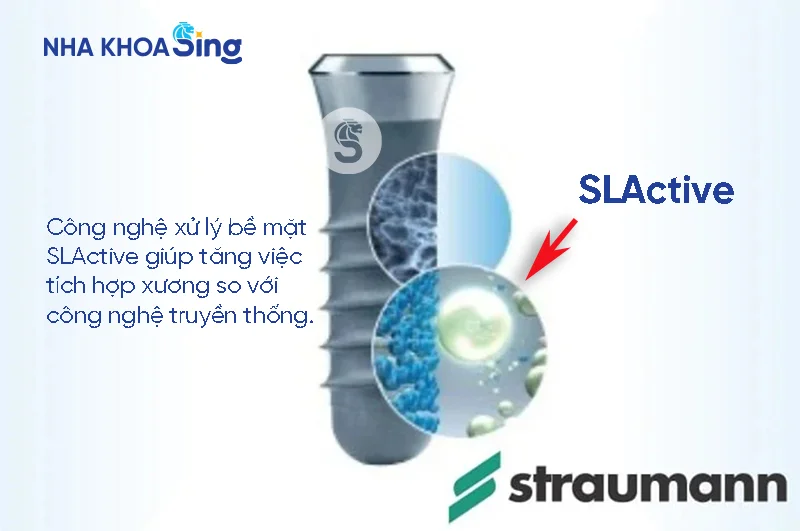 tru-implant-straumann-3