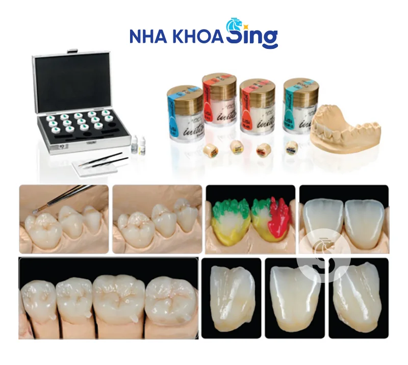 veneer-lisi-1