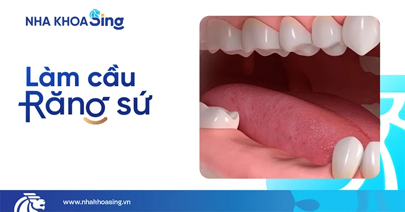 cac-phuong-phap-trong-rang-2