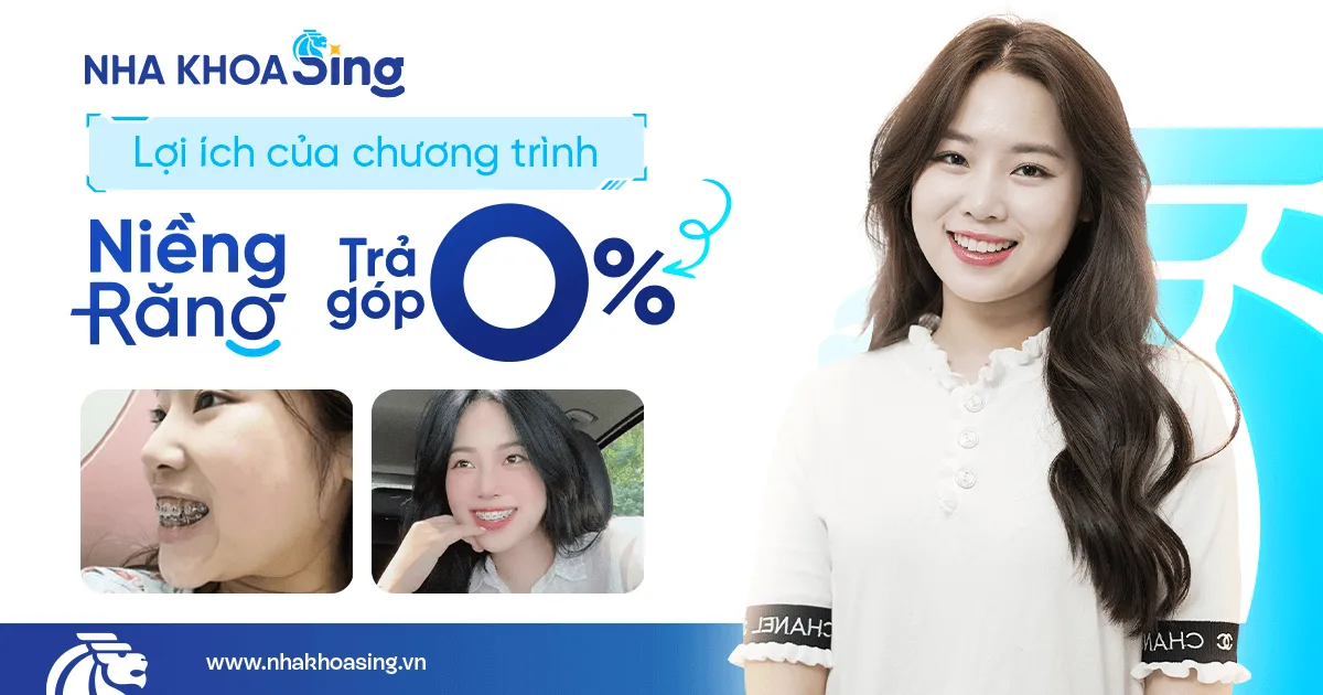 Niềng răng trả góp mang lại nhiều lợi ích về mặt kinh tế