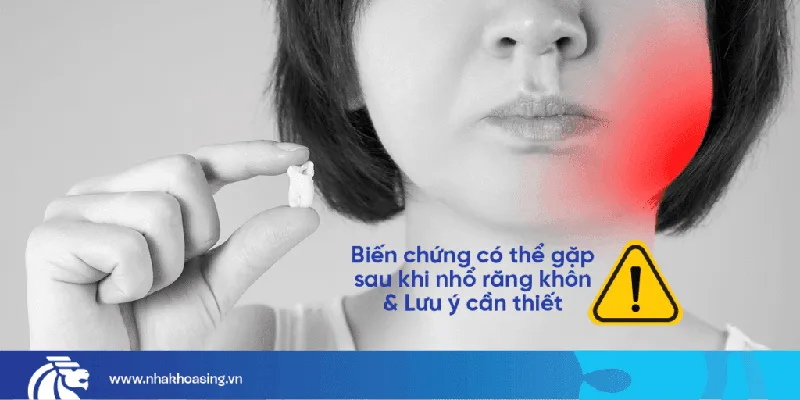bien-chung-nho-rang-khon