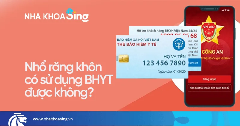 nho-rang-khon-co-su-dung-bao-hiem-y-te-duoc-khong-1.