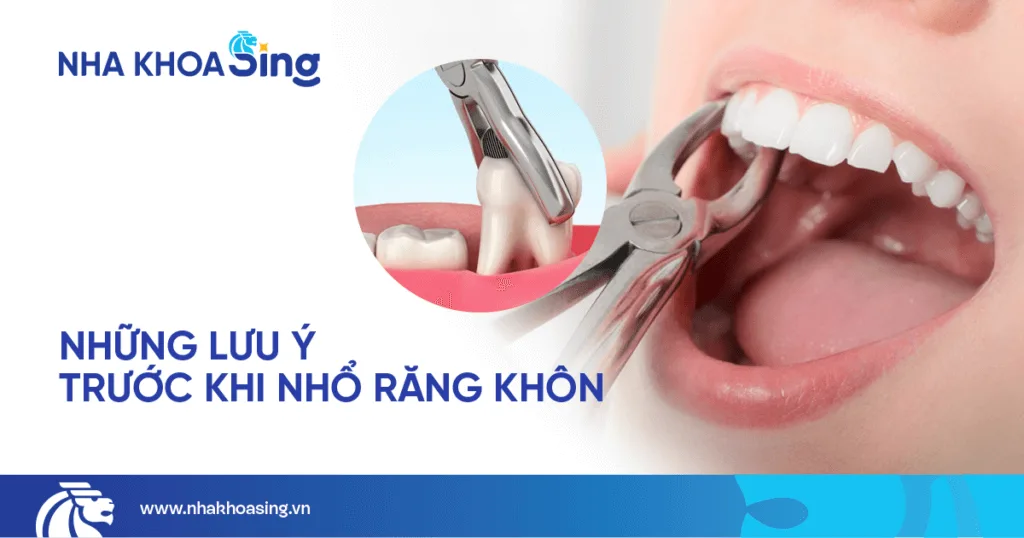 Những lưu ý trước khi nhổ răng khôn