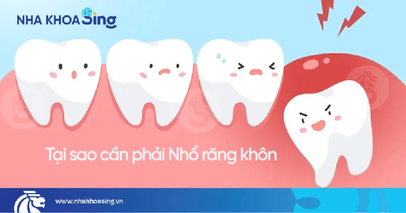 tai-sao-phai-nho-rang-khon-1.
