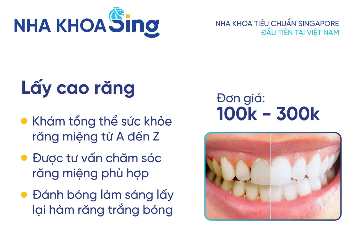 bang-gia-dich-vu-lay-cao-rang-nha-khoa-sing
