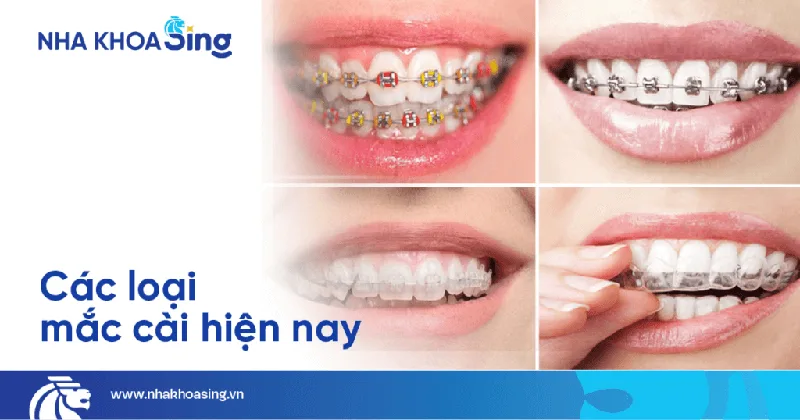 cac-loại-nieng-rang-mom