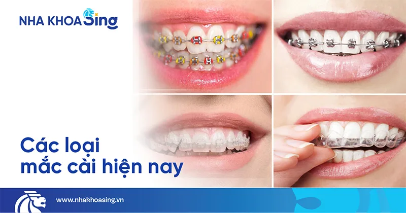 cac-loai-nieng-rang-mot-ham