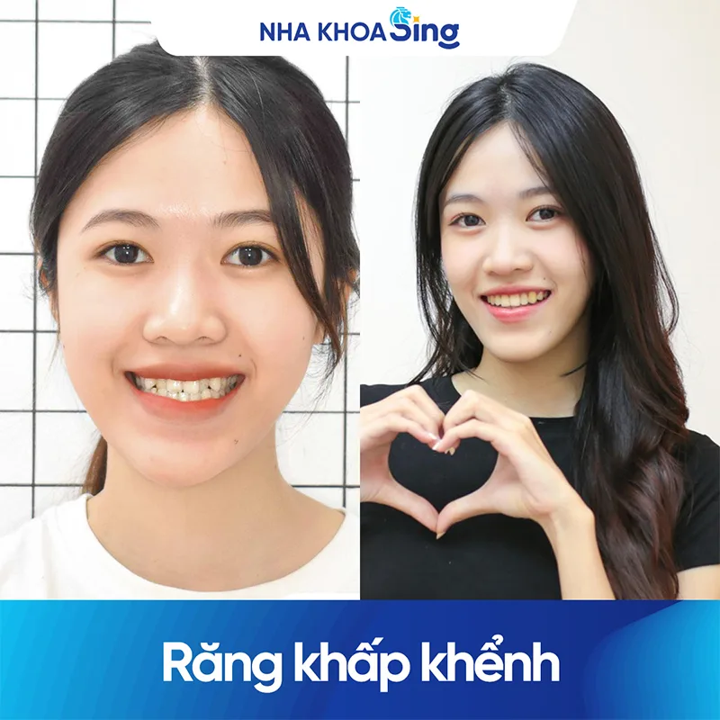 khach-hang-nieng-rang-mac-cai-tu-buoc-nha-khoa-sing