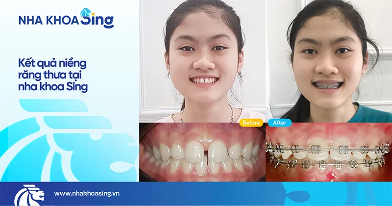 khach-hang-nieng-rang-thua-nha-khoa-sing