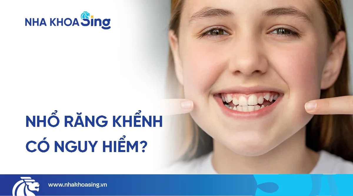 Nhổ răng khểnh có nguy hiểm không? Những lưu ý quan trọng