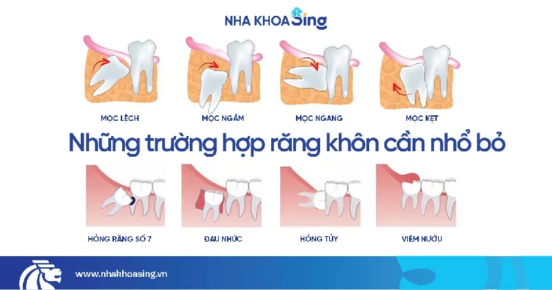 nho-rang-khon