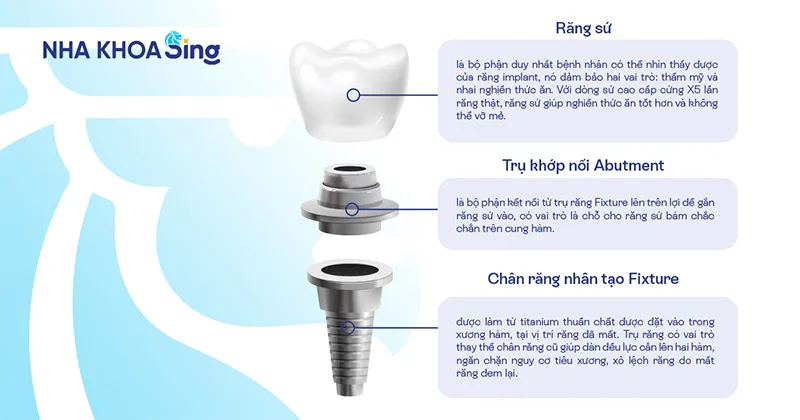 cau-tao-rang-implant