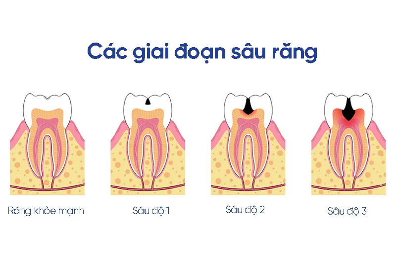 han-rang-sau-2