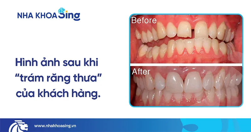 khach-hang-tram-rang-thua