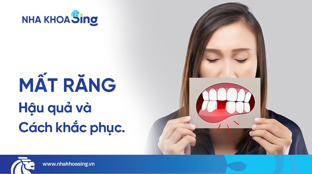 Mất răng: Hậu quả & cách khắc phục an toàn nhất
