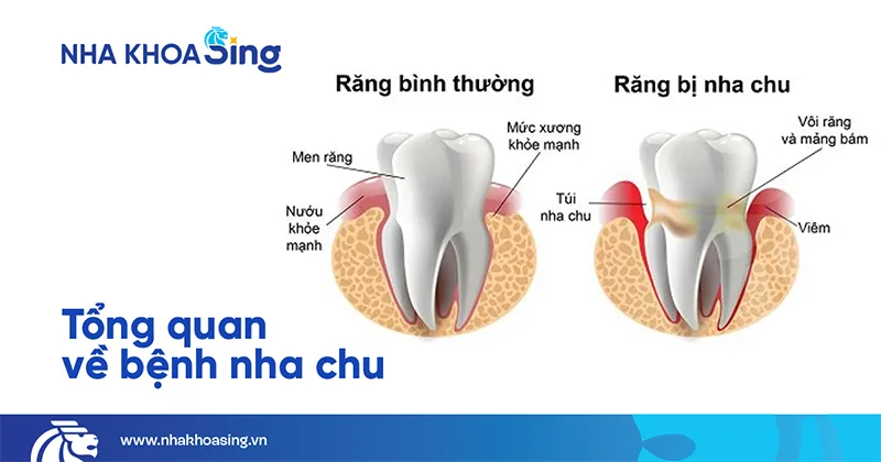 viem-nha-chu