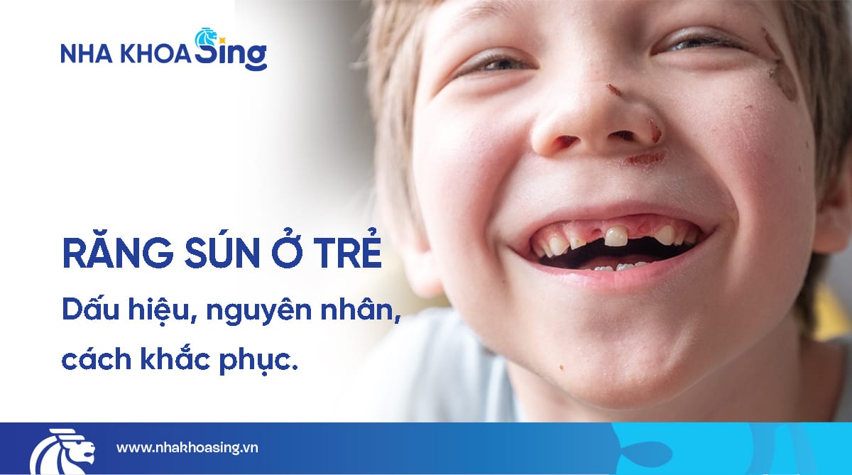 Răng sún ở trẻ em: Dấu hiệu, nguyên nhân và cách phòng ngừa