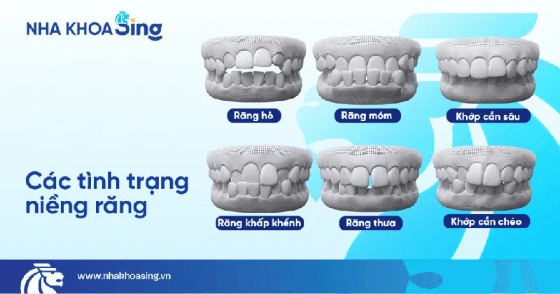 nieng-rang-nhanh-3