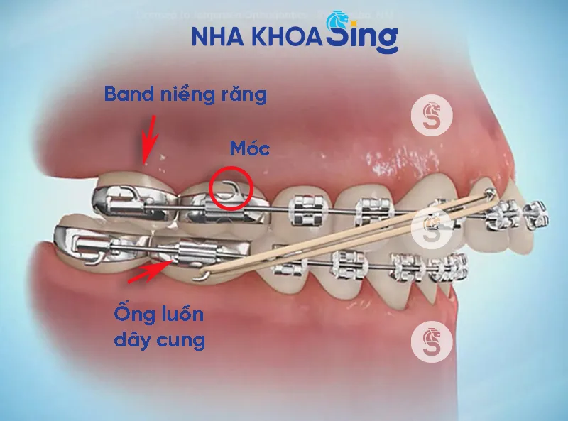 band-nieng-rang-2.